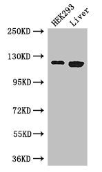 Western Blot Positive WB detected in: HEK293 whole cell lysate, Mouse liver tissue All lanes: PDGFRA antibody at 3ug/ml Secondary Goat polyclonal to rabbit IgG at 1/50000 dilution Predicted band size: 123, 25, 83 kDa Observed band size: 123 kDa