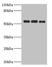 Western blot All lanes: PDHX antibody at 6ug/ml Lane 1: 293T whole cell lysate Lane 2: PC-3 whole cell lysate Lane 3: MCF-7 whole cell lysate Secondary Goat polyclonal to rabbit IgG at 1/10000 dilution Predicted band size: 55, 30, 52 kDa Observed...