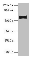Western blot All lanes: Pdia2 antibody at 10µg/ml + Hela whole cell lysate Secondary Goat polyclonal to rabbit IgG at 1/10000 dilution Predicted band size: 59, 58 kDa Observed band size: 59 kDa