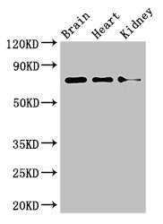 Western Blot Positive WB detected in: Mouse brain tissue, Mouse heart tissue, Mouse kidney tissue All lanes: PDIA4 antibody at 4µg/ml Secondary Goat polyclonal to rabbit IgG at 1/50000 dilution Predicted band size: 73 kDa Observed band size: 73 kDa