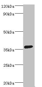 Western blot All lanes: PDZ and LIM domain protein 1 antibody at 2ug/ml + HepG2 whole cell lysate Secondary Goat polyclonal to rabbit IgG at 1/10000 dilution Predicted band size: 36 kDa Observed band size: 36 kDa