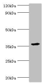 Western blot All lanes: PDZ and LIM domain protein 1 antibody at 10ug/ml + Mouse lung tissue Secondary Goat polyclonal to rabbit IgG at 1/10000 dilution Predicted band size: 36 kDa Observed band size: 36 kDa