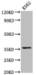 Western Blot Positive WB detected in: K562 whole cell lysate All lanes: PDLIM4 antibody at 6.1µg/ml Secondary Goat polyclonal to rabbit IgG at 1/50000 dilution Predicted band size: 36, 26 kDa Observed band size: 36 kDa