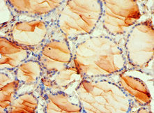 Immunohistochemistry of paraffin-embedded human thyroid tissue using CSB-PA017738ESR1HU at dilution of 1:100