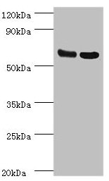 Western blot All lanes: PDPK1 antibody at 2.5µg/ml Lane 1: Hela whole cell lysate Lane 2: A549 whole cell lysate Secondary Goat polyclonal to rabbit IgG at 1/10000 dilution Predicted band size: 64, 59, 61, 49, 51 kDa Observed band size: 64 kDa