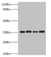 Western blot All lanes: PDXK antibody at 5.63µg/ml Lane 1: Mouse liver tissue Lane 2: Hela whole cell lysate Lane 3: Mouse kidney tissue Lane 4: HepG2 whole cell lysate Secondary Goat polyclonal to rabbit IgG at 1/10000 dilution Predicted band siz...