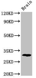 Western Blot Positive WB detected in: Rat brain tissue All lanes: Pdxp antibody at 2.8ug/ml Secondary Goat polyclonal to rabbit IgG at 1/50000 dilution Predicted band size: 32 kDa Observed band size: 32 kDa