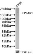 Western Blot Positive WB detected in: Rat liver tissue, Mouse kidney tissue All lanes: PEAR1 antibody at 5.2ug/ml Secondary Goat polyclonal to rabbit IgG at 1/50000 dilution Predicted band size: 111 kDa Observed band size: 111 kDa