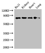 Western Blot Positive WB detected in: Raji whole cell lysate, Mouse kidney tissue, Rat heart tissue, Rat lung tissue All lanes: PECAM1 antibody at 2.7ug/ml Secondary Goat polyclonal to rabbit IgG at 1/50000 dilution Predicted band size: 83, 81, 80...