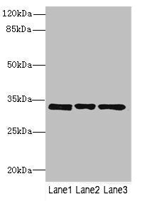 Western blot All lanes: PECR antibody at 3.27µg/ml Lane 1: MCF-7 whole cell lysate Lane 2: HepG2 whole cell lysate Lane 3: Hela whole cell lysate Secondary Goat polyclonal to rabbit IgG at 1/10000 dilution Predicted band size: 33, 17 kDa Observed...