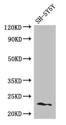 Western Blot Positive WB detected in: SH-SY5Y whole cell lysate All lanes: PEMT antibody at 2.8µg/ml Secondary Goat polyclonal to rabbit IgG at 1/50000 dilution Predicted band size: 23, 26, 25 kDa Observed band size: 23 kDa