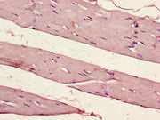 Immunohistochemistry of paraffin-embedded human skeletal muscle tissue using CSB-PA017786LA01HU at dilution of 1:100