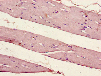 Immunohistochemistry of paraffin-embedded human skeletal muscle tissue using CSB-PA017786LA01HU at dilution of 1:100