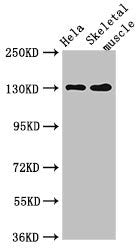 Western Blot Positive WB detected in: Hela whole cell lysate, Mouse skeletal muscle tissue All lanes: PER3 antibody at 4µg/ml Secondary Goat polyclonal to rabbit IgG at 1/50000 dilution Predicted band size: 132, 133 kDa Observed band size: 132 kDa