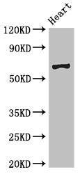 Western Blot Positive WB detected in: Mouse heart tissue All lanes: PES1 antibody at 3ug/ml Secondary Goat polyclonal to rabbit IgG at 1/50000 dilution Predicted band size: 69, 68 kDa Observed band size: 69 kDa