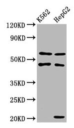 Western Blot Positive WB detected in: K562 whole cell lysate, HepG2 whole cell lysate All lanes: GATB antibody at 3.4µg/ml Secondary Goat polyclonal to rabbit IgG at 1/50000 dilution Predicted band size: 62 kDa Observed band size: 62 kDa