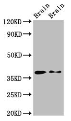 Western Blot Positive WB detected in: Rat brain tissue, Mouse brain tissue All lanes: PEX10 antibody at 2.7ug/ml Secondary Goat polyclonal to rabbit IgG at 1/50000 dilution Predicted band size: 38, 40 kDa Observed band size: 38 kDa