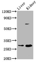 Western Blot Positive WB detected in: Rat liver tissue, Rat kidney tissue All lanes: PEX11A antibody at 2.37ug/ml Secondary Goat polyclonal to rabbit IgG at 1/50000 dilution Predicted band size: 29, 25 kDa Observed band size: 29 kDa