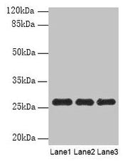 Western blot All lanes: PEX11B antibody at 10µg/ml Lane 1: 293T whole cell lysate Lane 2: Hela whole cell lysate Lane 3: K562 whole cell lysate Secondary Goat polyclonal to rabbit IgG at 1/10000 dilution Predicted band size: 29, 27 kDa Observed ba...