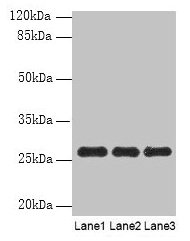 Western blot All lanes: PEX11B antibody at 10µg/ml Lane 1: 293T whole cell lysate Lane 2: Hela whole cell lysate Lane 3: K562 whole cell lysate Secondary Goat polyclonal to rabbit IgG at 1/10000 dilution Predicted band size: 29, 27 kDa Observed ba...