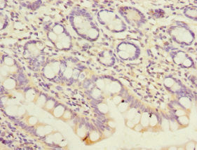 Immunohistochemistry of paraffin-embedded human small intestine tissue using CSB-PA017802DSR2HU at dilution of 1:100