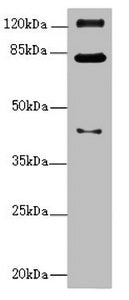 Western blot All lanes: PEX3 antibody at 1.11ug/ml + Mouse kidney tissue Secondary Goat polyclonal to rabbit IgG at 1/10000 dilution Predicted band size: 42 kDa Observed band size: 42, 82, 125 kDa