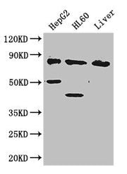 Western Blot Positive WB detected in: HepG2 whole cell lysate, HL60 whole cell lysate, Mouse liver tissue All lanes: PFKL antibody at 2.8ug/ml Secondary Goat polyclonal to rabbit IgG at 1/50000 dilution Predicted band size: 86, 91 kDa Observed ban...