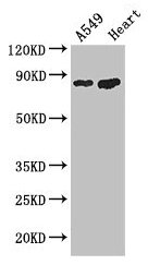 Western Blot Positive WB detected in: A549 whole cell lysate, Mouse heart tissue All lanes: PFKM antibody at 3.4µg/ml Secondary Goat polyclonal to rabbit IgG at 1/50000 dilution Predicted band size: 86, 82, 94 kDa Observed band size: 86 kDa