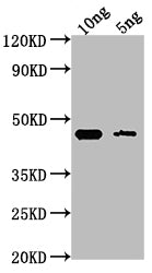Western Blot Positive WB detected in Recombinant protein All lanes: GPM1 antibody at 1:2000 Secondary Goat polyclonal to rabbit IgG at 1/50000 dilution Predicted band size: 42.8 kDa Observed band size: 44 kDa