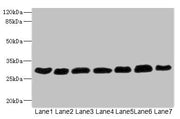Western blot All lanes: PGAM2 antibody at 7.28µg/ml Lane 1: Rat heart tissue Lane 2: Mouse skeletal muscle tissue Lane 3: Hela whole cell lysate Lane 4: HepG2 whole cell lysate Lane 5: Jurkat whole cell lysate Lane 6: MCF-7 whole cell lysate Lane...