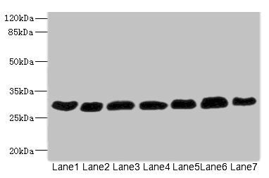 Western blot All lanes: PGAM2 antibody at 7.28µg/ml Lane 1: Rat heart tissue Lane 2: Mouse skeletal muscle tissue Lane 3: Hela whole cell lysate Lane 4: HepG2 whole cell lysate Lane 5: Jurkat whole cell lysate Lane 6: MCF-7 whole cell lysate Lane...