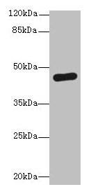 Western blot All lanes: PGK2 antibody at 6µg/ml + HepG2 whole cell lysate Secondary Goat polyclonal to rabbit IgG at 1/10000 dilution Predicted band size: 45 kDa Observed band size: 45 kDa