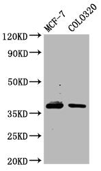 Western Blot Positive WB detected in: MCF-7 whole cell lysate, Colo320 whole cell lysate All lanes: PGLYRP3 antibody at 4.86µg/ml Secondary Goat polyclonal to rabbit IgG at 1/50000 dilution Predicted band size: 38 kDa Observed band size: 38 kDa