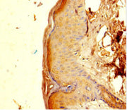 Immunohistochemistry of paraffin-embedded human skin tissue using CSB-PA017865LA01HU at dilution of 1:100