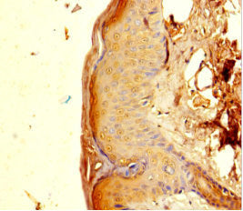 Immunohistochemistry of paraffin-embedded human skin tissue using CSB-PA017865LA01HU at dilution of 1:100