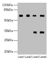 Western blot All lanes: PGM1 antibody at 6µg/ml Lane 1: U251 whole cell lysate Lane 2: U937 whole cell lysate Lane 3: Jurkat whole cell lysate Lane 4: Hela whole cell lysate Secondary Goat polyclonal to rabbit IgG at 1/10000 dilution Predicted ban...