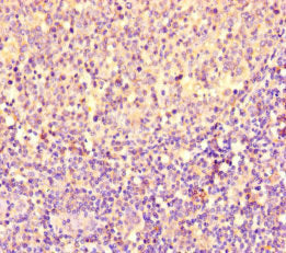 Immunohistochemistry of paraffin-embedded human tonsil tissue using CSB-PA017873LA01HU at dilution of 1:100