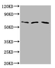 Western Blot Positive WB detected in: Hela whole cell lysate, Rat brain tissue, Mouse brain tissue All lanes: PHACTR1 antibody at 6µg/ml Secondary Goat polyclonal to rabbit IgG at 1/50000 dilution Predicted band size: 67, 55 kDa Observed band size...