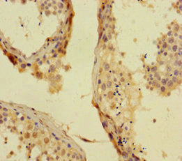 Immunohistochemistry of paraffin-embedded human testis tissue using CSB-PA017891HA01HU at dilution of 1:100