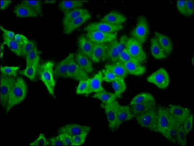 Immunofluorescence staining of HepG2 cells with CSB-PA017896LA01HU at 1:133, counter-stained with DAPI. The cells were fixed in 4% formaldehyde, permeabilized using 0.2% Triton X-100 and blocked in 10% normal Goat Serum. The cells were then incuba...