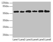 Western blot All lanes: PHF10 antibody at 8µg/ml Lane 1: Hela whole cell lysate Lane 2: 293T whole cell lysate Lane 3: A2780 whole cell lysate Lane 4: U251 whole cell lysate Lane 5: A549 whole cell lysate Lane 6: A375 whole cell lysate Secondary G...