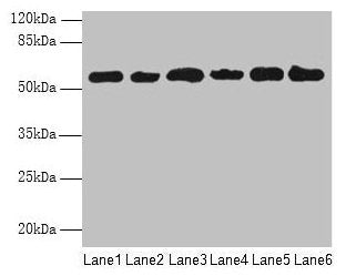 Western blot All lanes: PHF10 antibody at 8µg/ml Lane 1: Hela whole cell lysate Lane 2: 293T whole cell lysate Lane 3: A2780 whole cell lysate Lane 4: U251 whole cell lysate Lane 5: A549 whole cell lysate Lane 6: A375 whole cell lysate Secondary G...