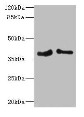 Western blot All lanes: PHF11 antibody at 4.36µg/ml Lane 1: Jurkat whole cell lysate Lane 2: Hela whole cell lysate Secondary Goat polyclonal to rabbit IgG at 1/10000 dilution Predicted band size: 38, 34 kDa Observed band size: 38 kDa