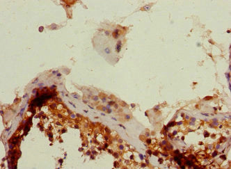 Immunohistochemistry of paraffin-embedded human testis tissue using CSB-PA017900ESR2HU at dilution of 1:100