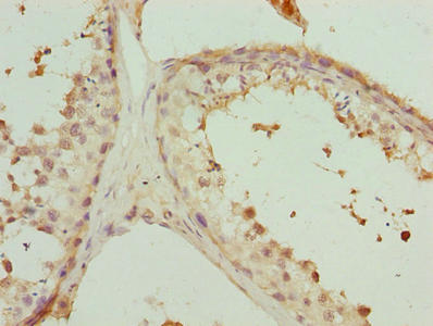 Immunohistochemistry of paraffin-embedded human testis tissue using CSB-PA017902LA01HU at dilution of 1:100