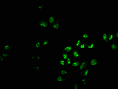 Immunofluorescence staining of Hela cells with CSB-PA017917LA01HU at 1:233, counter-stained with DAPI. The cells were fixed in 4% formaldehyde, permeabilized using 0.2% Triton X-100 and blocked in 10% normal Goat Serum. The cells were then incubat...
