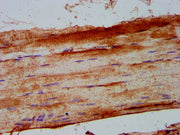 IHC image of CSB-PA017922LA01HU diluted at 1:500 and staining in paraffin-embedded human skeletal muscle tissue performed on a Leica BondTM system. After dewaxing and hydration, antigen retrieval was mediated by high pressure in a citrate buffer (...