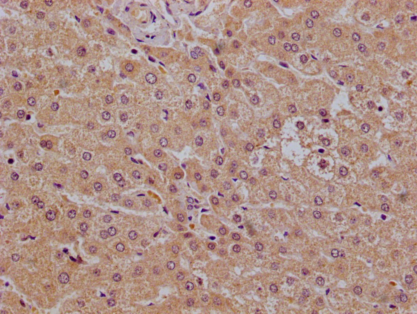 Immunohistochemistry of paraffin-embedded human liver using CSB-PA017932LA01HU at dilution of 1:100