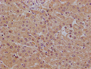 Immunohistochemistry of paraffin-embedded human liver using CSB-PA017932LA01HU at dilution of 1:100
