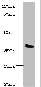 Western blot All lanes: Phytanoyl-CoA dioxygenase, peroxisomal antibody at 3ug/ml + Mouse liver tissue Secondary Goat polyclonal to rabbit IgG at 1/10000 dilution Predicted band size: 39, 28 kDa Observed band size: 39 kDa